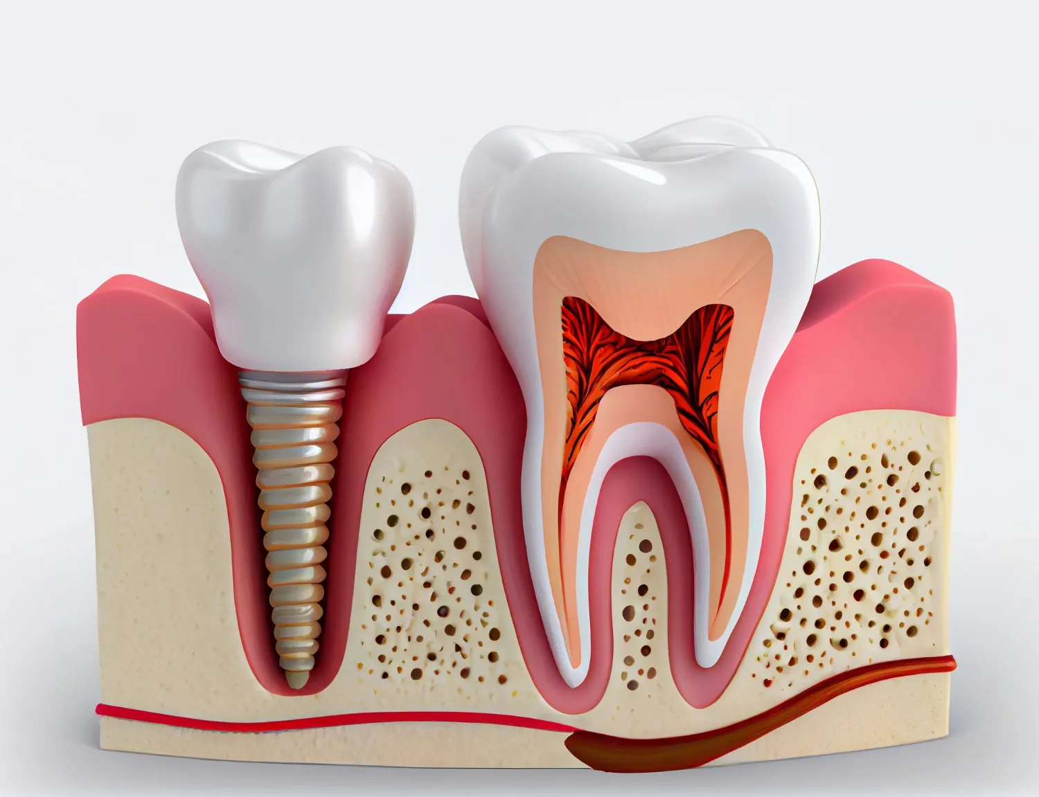 dentist in Indore, root canal treatment