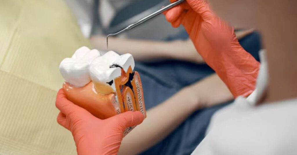 best dentist for wisdom tooth removal in Indore, wisdom tooth removal treatment in indore