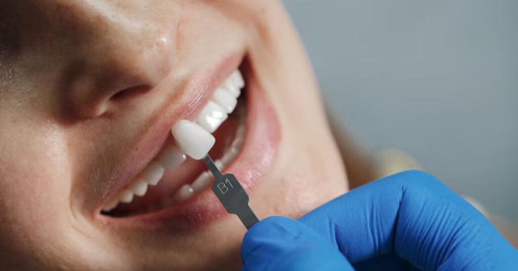 dental implants in indore, root canal treatment in indore