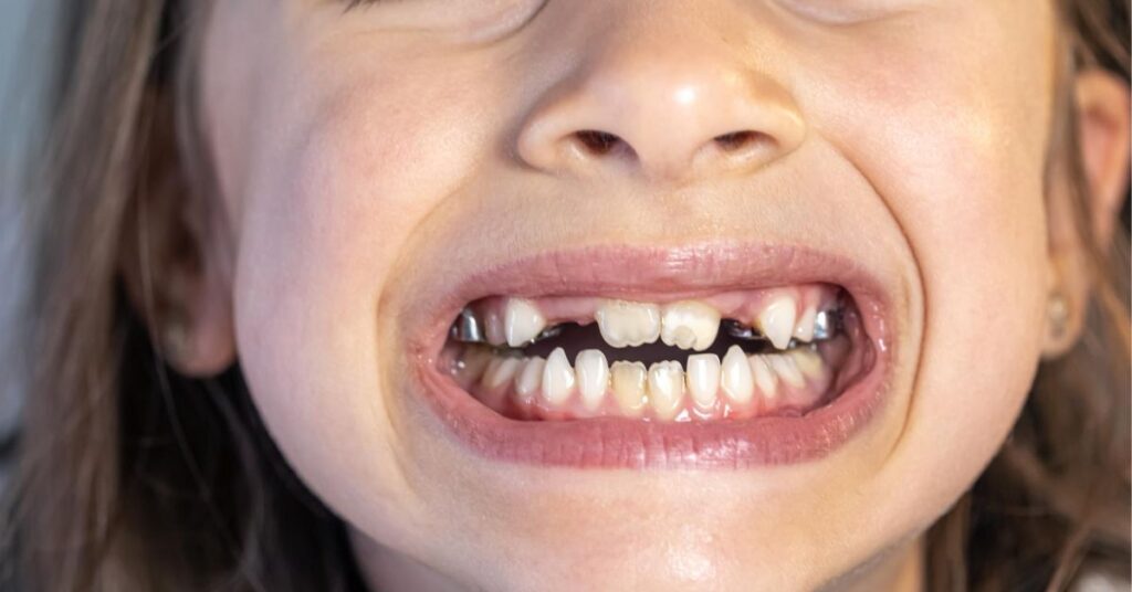 Patient experiencing late growing teeth pain issues due to wisdom tooth growth and seeking dental evaluation