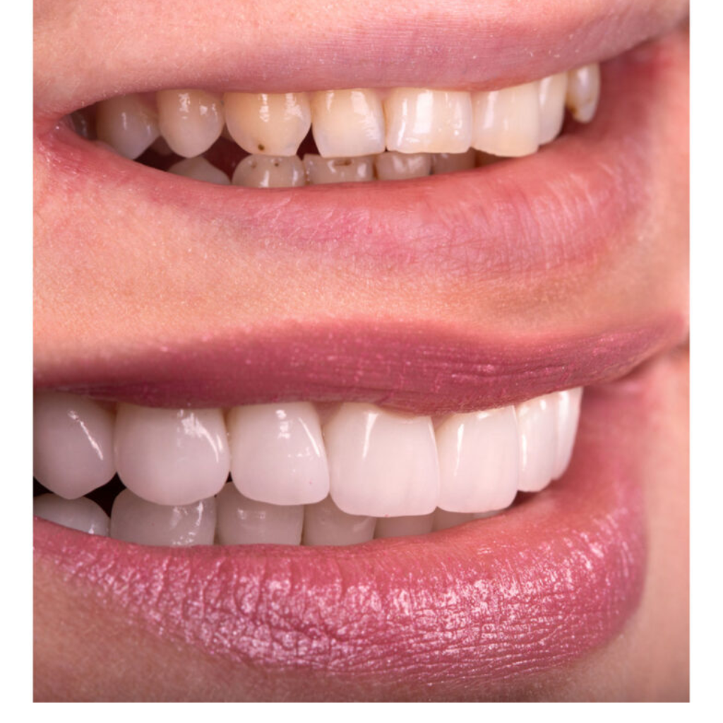 dental treatments.