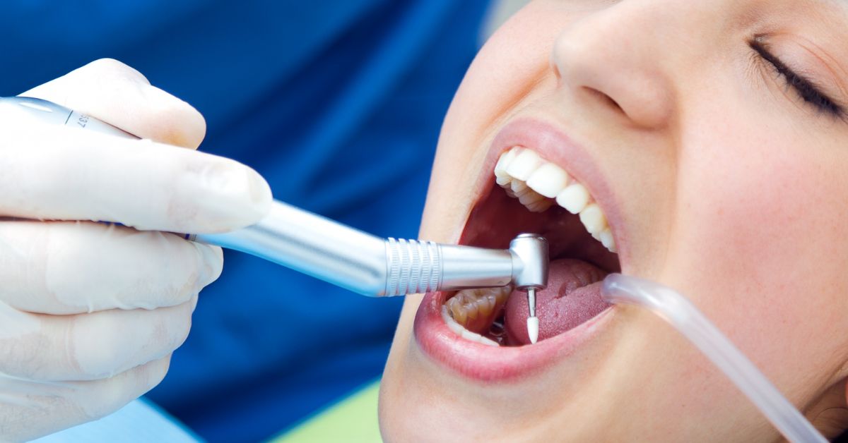 root canal treatment in Indore for tooth pain and deep cavity infection