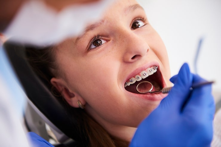 Neuromuscular orthodontics treatment in Indore at Smile Dental Clinic