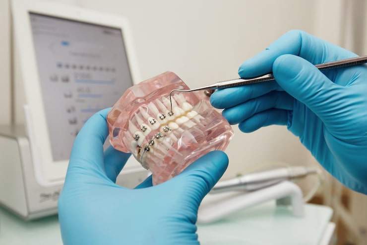 Neuromuscular orthodontics treatment in Indore at Smile Dental Clinic